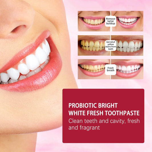 Probiotic Ultra Whitening Toothpaste - Buy 1 Get 1 Free