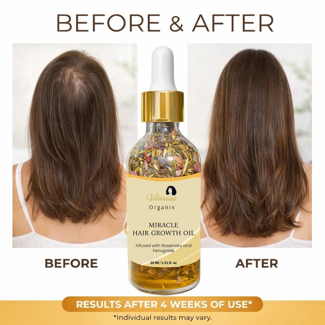 Miracle Hair Growth Oil 30 ml: Buy 1 Get 1 Free