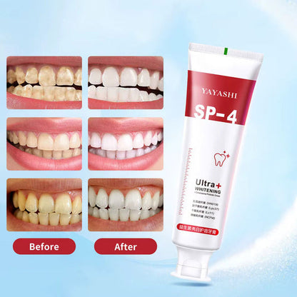 Probiotic Ultra Whitening Toothpaste - Buy 1 Get 1 Free